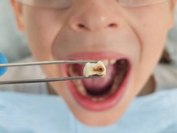 Best Emergency Broken Tooth Repair in Sanborn, NY